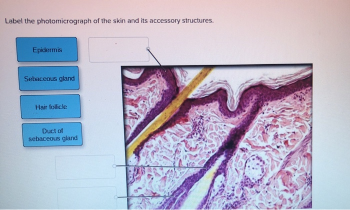 Label the photomicrograph of the skin and its accessory structures