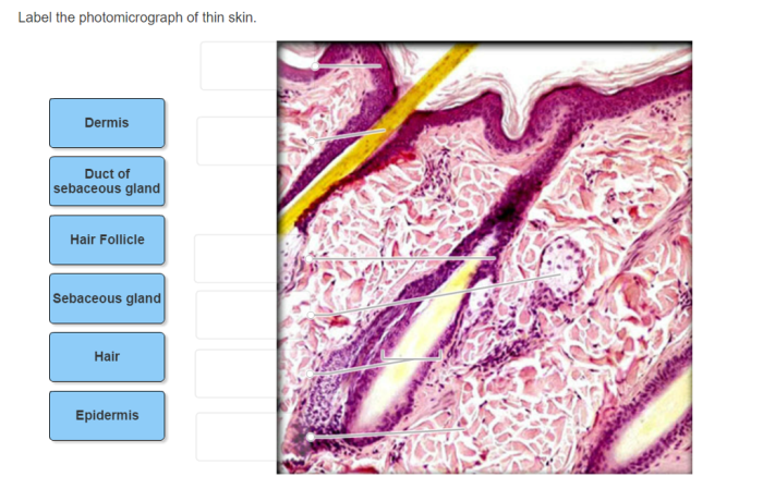 Skin photomicrograph thick biology answers questions