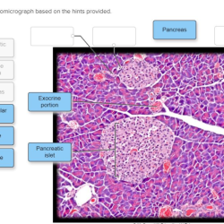 Gland sebaceous photomicrograph label chegg transcribed text show